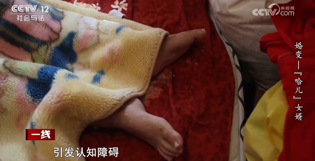 女子在丈夫瘫痪期间另交男友并怀孕,要求离婚,丈夫不同意!离婚官司开打,岳父竟是女婿的代理人……